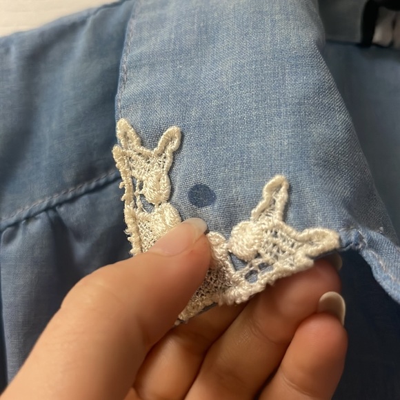 Button top - Picture 3 of 7